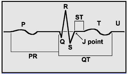 Điểm J là phần tiếp giáp giữa chấm dứt phức bộ QRS và bắt đầu của đoạn ST