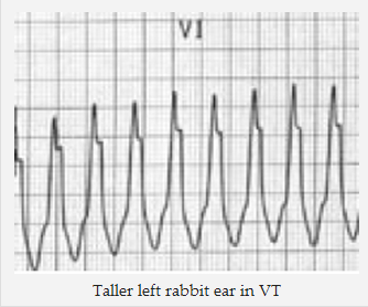 Cao tai thỏ bênh trái trong VT