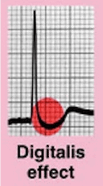 Điểm J âm