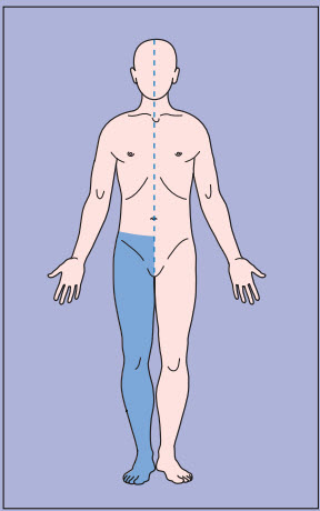 Cơ chế gây yếu cơ dựa trên các kiểu dấu hiệu lâm sàng chân