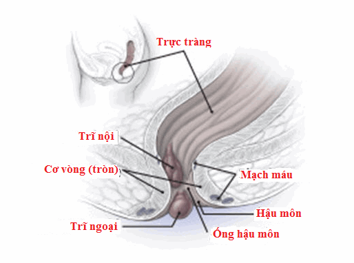 Bệnh trĩ là các tĩnh mạch phình to hình thành hoặc trĩ ngoại