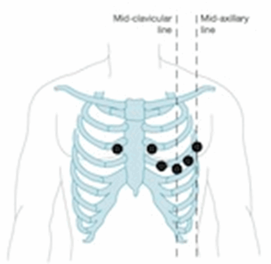 Hệ thống 12 đạo trình điện tâm đồ (ECG)