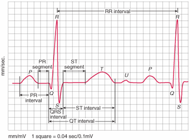 Khoảng thời gian PR là thời gian từ khi bắt đầu của sóng P đến đầu QRS