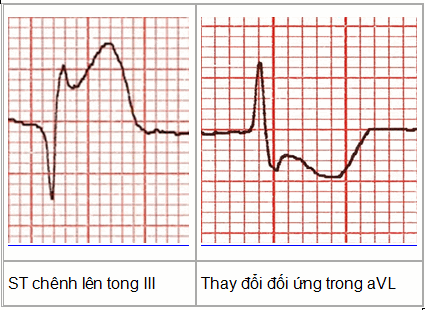 Thay đổi đối ứng