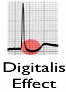 Hiệu quả Digoxin: