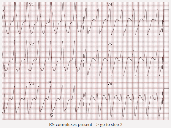 Phức hợp RS hiện diện