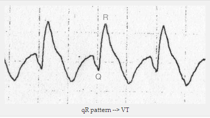 Mẫu qR => VT