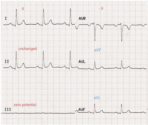 Đảo ngược LA / RL (N)