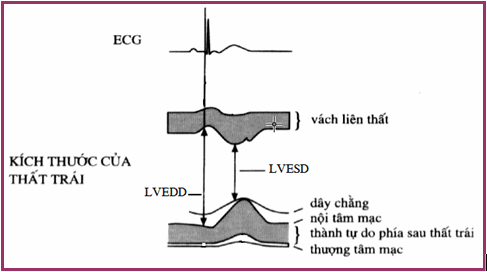 Vị trí đo kích thước thất trái trên hình ảnh TM hoặc 2D