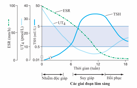 Viêm tuyến giáp bán cấp