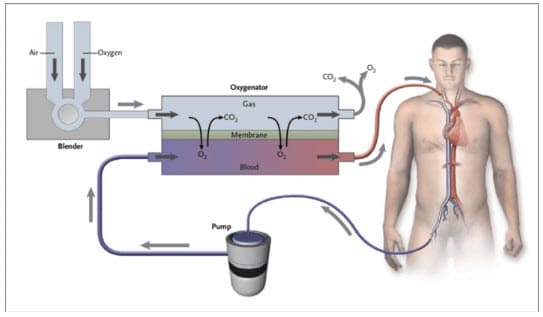 Hình ảnh máy Ecmo