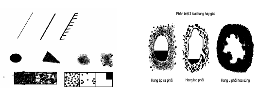 Mô tả hình ảnh bóng mờ (trái) và các hình hang thường gặp (phải).