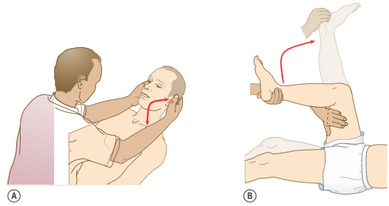 Kiểm tra dấu hiệu kích thích màng não