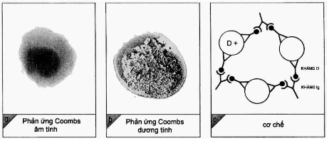 Phản ứng Coombs gián tiếp