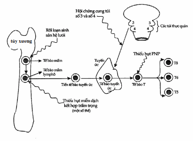 Sơ đồ các giai đoạn trưởng thành tế bào T và những vị trí mà thiếu hụt miễn dịch tế bào có thể xảy ra