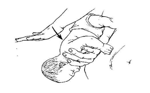 Thối với các trẻ sơ sinh nhẹ nhàng nhưng vững chắc năm lần bằng cách sử dụng bàn tay