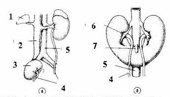 A. Thận đáy chậu 1 bên, B. Thận móng ngựa