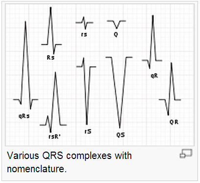 Phức bộ QRS