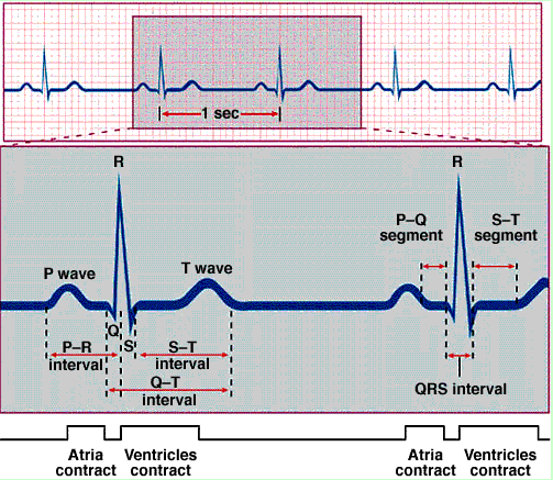 Phức bộ QRS bình thường