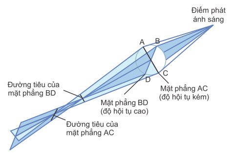 Bệnh loạn thị, chứng tỏ tia sáng hội tụ tại một tiêu điểm trong một tiêu diện