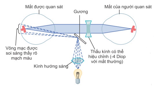  Hệ thống quang học của kính soi đáy mắt