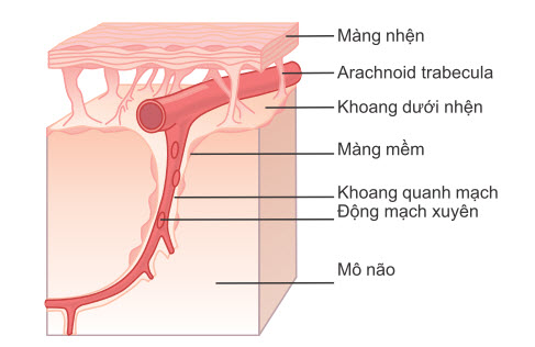 Dẫn lưu khoang quanh mạch vào khoang dưới nhện