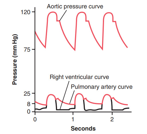 Các đường xung áp lực trong tâm thất phải, động mạch phổi và động mạch chủ