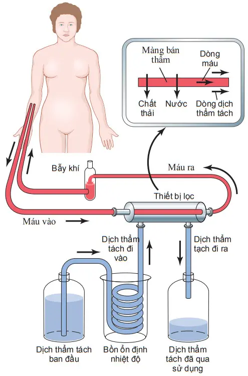 Nguyên tắc lọc máu với thận nhân tạo