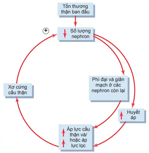 Vòng xoắn bệnh lý xảy ra trên tổn thương thận ban đầu