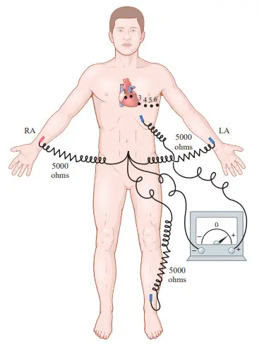 Các kết nối của cơ thể với máy ghi điện tim để ghi các chuyển đạo ngực