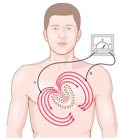 Di chuyển của dòng điện vào ngực xung quanh một phần khử cực tâm thất