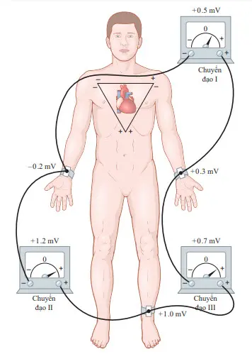 Sắp đặt quy ước của các điện cực để ghi lại các chuyển đạo điện tâm đồ tiêu chuẩn