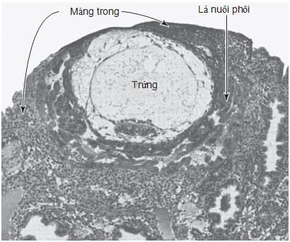 Trứng làm tổ