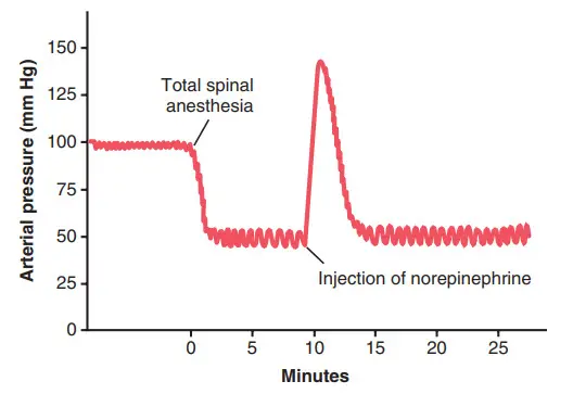 Ảnh hưởng của gây tê tủy sống toàn bộ lên áp lực động mạch