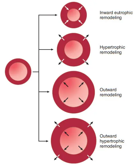 Cấu trúc lại mạch máu đáp ứng với sự tăng mạn tính áp lực hoặc lưu lượng máu