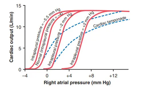 Cung lượng tim ở các áp suất khoang màng phổi
