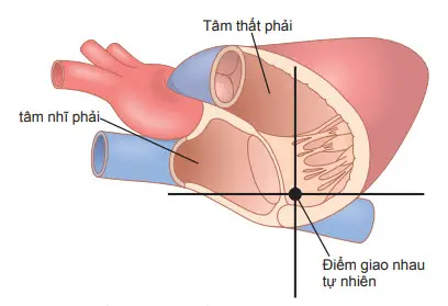 Điểm giao nhau để đo áp lực tuần hoàn