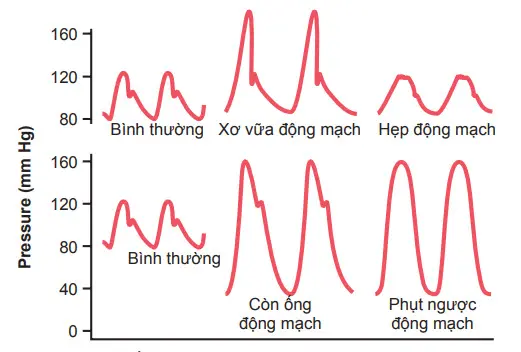 Huyết áp ở người bình thường và bệnh lý