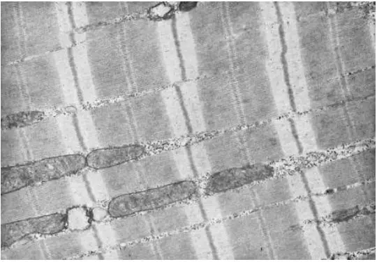 Ảnh hiển vi điện tử của các tơ cơ cơ cho thấy việc tổ chức chi tiết của các sợi actin và myosin