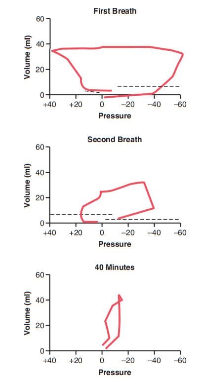 Các đường cong thể tích áp suất của phổi