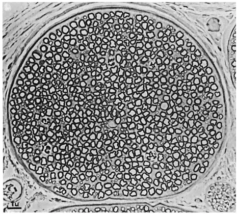 Mặt cắt ngang của một thân thần kinh nhỏ chứa cả sợi myelin và sợi không myelin