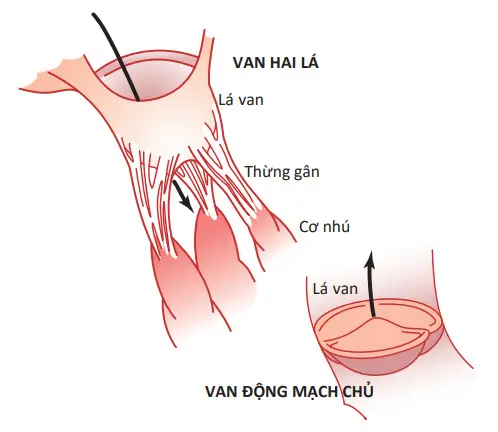 Van hai lá và động mạch chủ (van tâm thất trái)