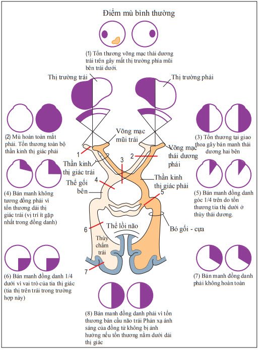 Cơ chế gây mất thị trường